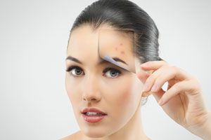 Ilustración de Cómo combatir el acné. La solución