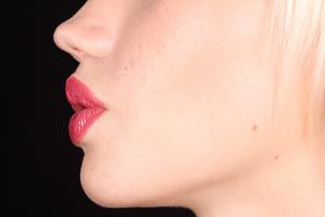 Ilustración de Cómo dar volumen a los labios finos