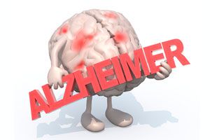 Ilustración de ¿Qué es el Alzheimer?